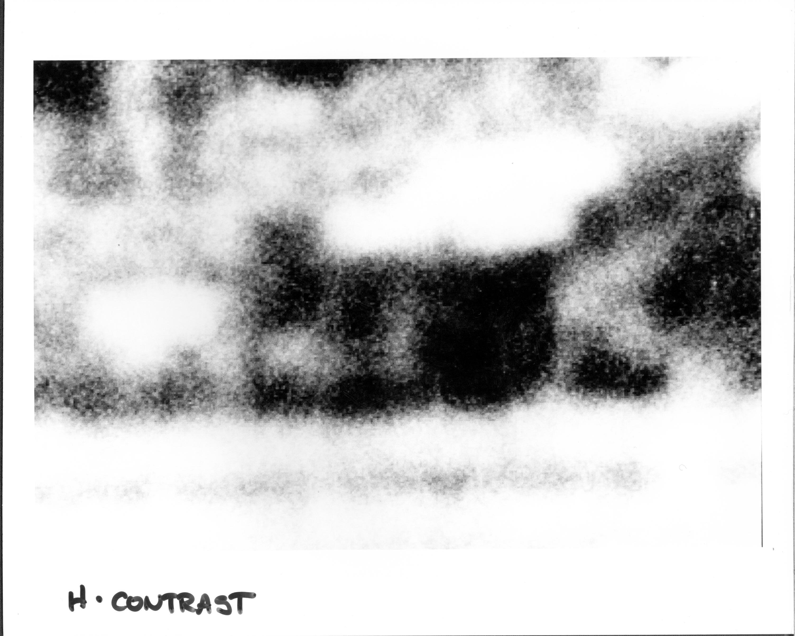 Ehanced Arnold House photographs LIHO NHS- Arnold House, enlargement, high contrast Arnold House